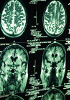 Human Paraffin Tissue Sections - Neural system