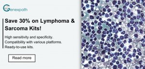 30% OFF: Diagnostic Lymphoma & Sarcoma Kits!