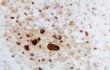 Anti-TRAcP CE/IVD for IHC - Hematopathology