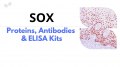 Impulse la investigación de enfermedades con proteínas SOX, anticuerpos y kits ELISA