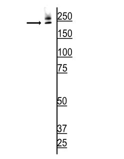 Western blot of 70 day old mouse retina lysate showing immunolabeling of the ~220 kDa ABCA4 protein at a dilution of 1:1000.