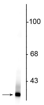 Western blot of rat kidney lysate showing specific immunolabeling of the ~21 kDa Park7 protein.