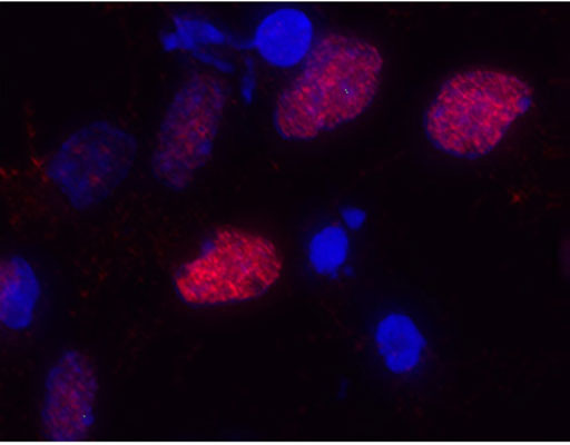 Immunostaining of primary rat cortical neuroepithelial cells with anti-Olig2 (cat. 1538-OLIG2, red, 1:1000). The cells were treated with basic FGF for 30 hours prior to staining (this induces Olig2 expression in these primary cells).