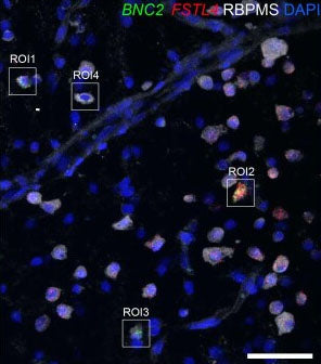 Representative confocal image of a horizontal section of the macaque ganglion cell layer immunolabeled with a pan-RGC marker (RBPMS, Cat. 1830-RBPMS, white) and probed by RNA in situ hybridization for BNC2 (green) and FSTL4 (red) mRNA. Nuclei are counterstained with DAPI. Image from publication CC-BY-4.0. 