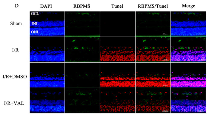 Immunostaining of retinas in control, I/R, I/R+DMSO and I/R+VAL groups, stained with DAPI (blue), RBPMS (green) and TUNEL (red). Image from publication CC-BY-4.0. PMID: 36361772