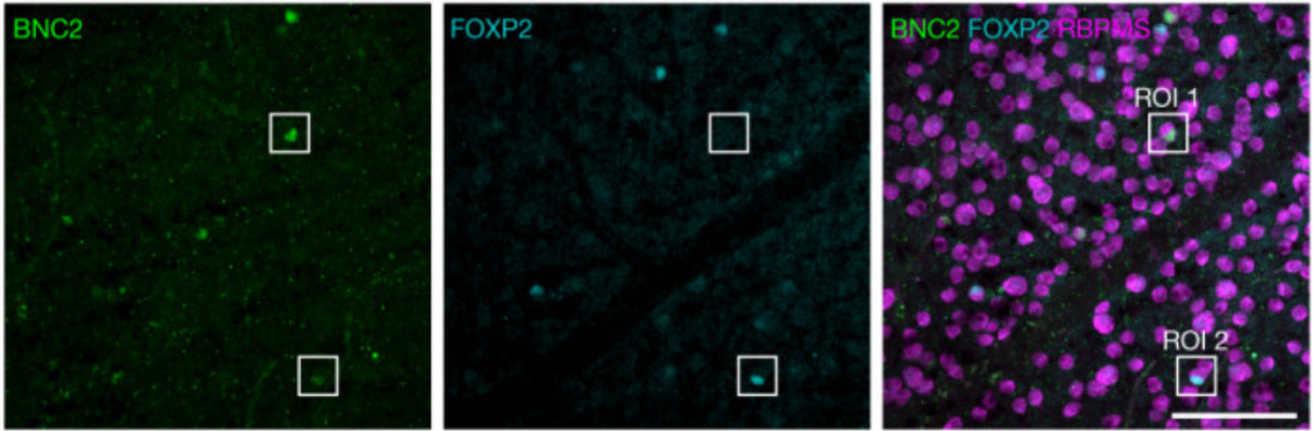 Representative confocal image of macaque GCL immunolabelled for BNC2, FOXP2 and RBPMS (cat. 1830-RBPMS). Image from publication CC-BY-4.0. PMID: 37880369