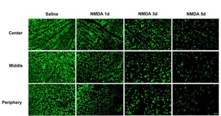 Immunofluorescence staining of flat-mounted mice retinas with RBPMS (green) at different times after NMDA injury. RGCs were quantified in three areas (center, middle, periphery) in each of the four quadrants of the retina depending on relative location to optic nerve head. Image from publication CC-BY-4.0. PMID: 36289519