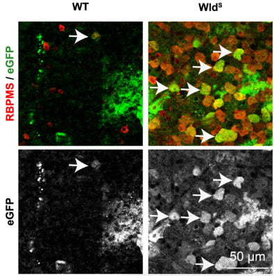 RBPMS staining (cat. 1832-RBPMS, 1:500; red) and eGFP staining (green in upper panels and grey in lower panels) in post-mortem retinal explants of C57BL/6J and B6.BOla-WldS mice that were transduced with AAV2-SYN-eGFP ex vivo. Mouse explants were stained for eGFP. Image from publication CC-BY-4.0. PMID: 36635457