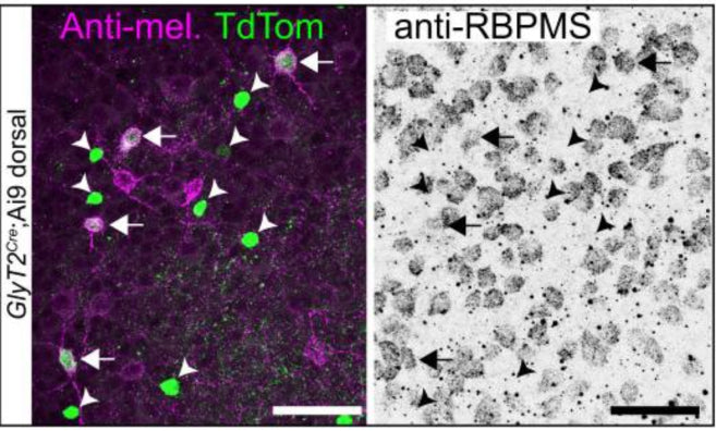 Confocal micrograph of melanopsin, TdTomato, and RBPMS (cat. 1832-RBPMS) co-staining in the dorsal GlyT2Cre;Ai9 mouse retina. The left arrows indicate RBPMS-positive GlyT2Cre ipRGCs. All melanopsin-negative, TdTomato-positive cells are RBPMS negative (arrowheads). Image from publication CC-BY-4.0. PMID: 36932080