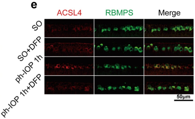 Immunostaining of ACSL4 (red) in retinal ganglion cells (counterstained with RBPMS; green) in sham operation (SO) and ph-IOP injured mice, with or without DFP treatment. Image from publication CC-BY-4.0. PMID: 35933500