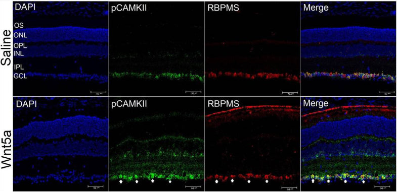 Upper panel shows representative images of cross-sections of saline-injected mouse retinas and lower panel shows representative images of cross-sections of 50 ng Wnt5a-injected mouse retinas co-immunostained with phospho CamKII (green), RBPMS (red), and DAPI (blue). Image from publication CC-BY-4.0. PMID: 35914928