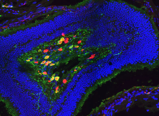 Immunostaining of retinal ganglion cells from the blind mole rat, Spalax Ehrenbergi, stained for RBPMS (red), melanopsin (green), and DAPI (blue). Credit: Jens Hannibal, Ass. Professor, MD, PhD., DmSc. Dept. Clinical Biochemistry, Bispebjerg Hospital, University of Copenhagen, Denmark.