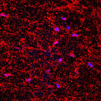 Immunofluorescence of a transversal section from mouse spinal cord labeling fibers of collagen (cat. : 322-COLT, red, 1:200) from the tissue scaffold. The blue is DAPI counterstaining nuclear DNA. Image kindly provided by Dr. Rodolfo Gatto and Dr. Gerardo Morfini, Department of Anatomy and Cell biology, University of Illinois at Chicago.