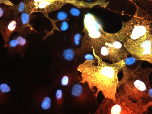 Immunofluoresence of FLAG-tagged AIF1 transfected COS cells showing AIF1 staining in red (cat. 91-AIF1, 1:50) and FLAG staining in green causing positive transfected cells to appear yellow. DNA is stained blue with DAPI.