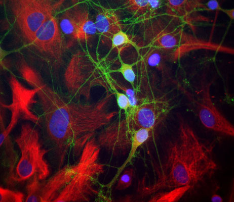 Immunofluorescence of cultured neurons and glia cells showing specific labeling of neuronal perikarya, axons and dendrites with anti-alpha-II-spectrin (cat. 99-A2SR, 1:1000, green), specific labeling of intermediate filaments in glial and fibroblastic cells with anti-vimentin (cat. 2105-VIM, 1:5000, red) and nuclear staining with DAPI (blue). 