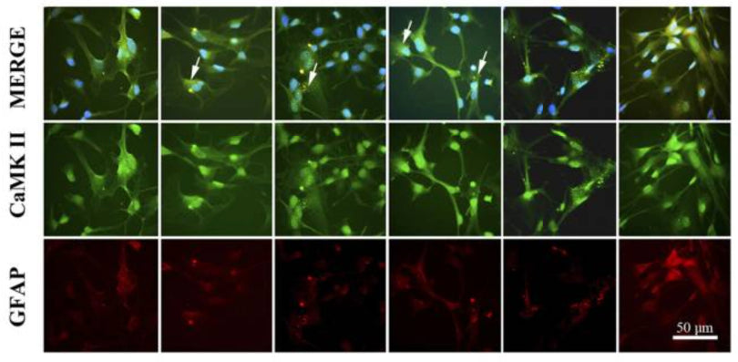 Anti-CaM Kinase II (Thr286) Antibody