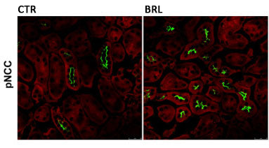 Immunostaining of mouse kidney sections from control (CTL) and BRL37344 treated (BRL, 1 mg/kg) specifically labeling localized phosphorylated NCC thr53 (Cat p1311-53, green) and counterstained with Evans Blue (in red). Image from publication. CC-BY-4.0, PMID: 38652212