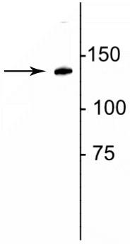 Western blot of rat lung lysate showing specific immunolabeling of the ~140 kDa collagen protein.