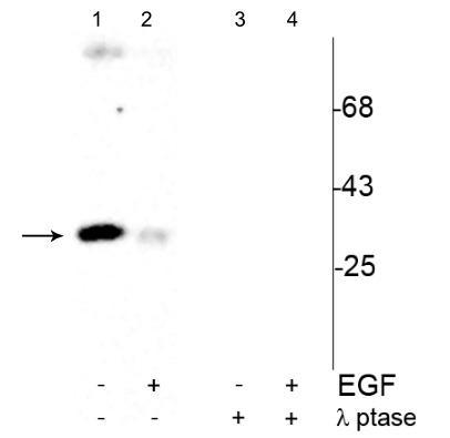 Western blot of human T47D cells showing specific immunolabeling of the ~34 kDa cdc2 phosphorylated at Tyr15 (Control, Lane 1). Treatment with EGF (30 ng per ml for 30 min) caused dephosphorylation of the Tyr15 on cdc2 (Lane 2). Phosphospecificity is shown in lanes 3 and 4, where the immunolabeling is completely eliminated by blot treatment with lambda phosphatase, λ-Ptase (1200 units for 30 min).