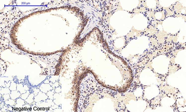 Fig.2. Immunohistochemical analysis of paraffin-embedded rat lung tissue. 1, Stat3 (phospho Tyr705) Polyclonal Antibody was diluted at 1:200 (4°C, overnight). 2, Sodium citrate pH 6.0 was used for antibody retrieval (>98°C, 20min). 3, secondary antibody was diluted at 1:200 (room temperature, 30min). Negative control was used by secondary antibody only.