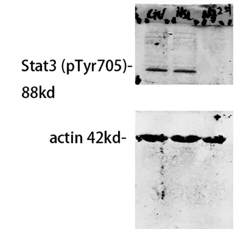 Fig.3. Western Blot analysis of our customer's samples using primary antibody diluted at 1:500, The picture was kindly provided by our customer.