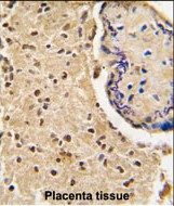 IHC-P - HtrA3 Antibody (N-term) AP1332a