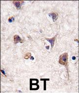 IHC-P - LC3 Antibody (APG8A) (N-term) AP1801A