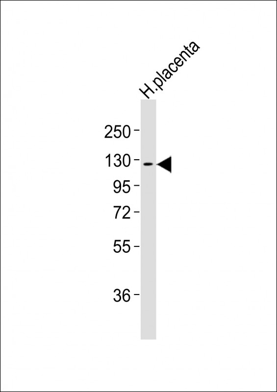 WB - CSF1R Antibody AM8467b