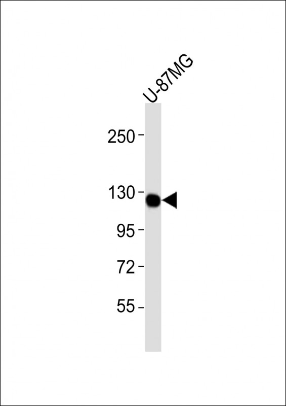 WB - CSF1R Antibody AM8467b