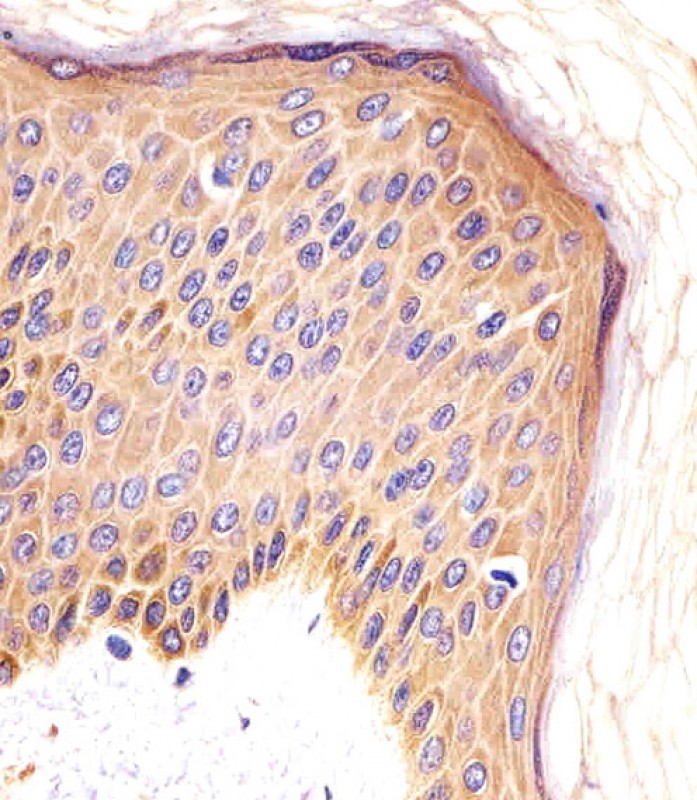 IHC-P - CSF1R Antibody AM8467b