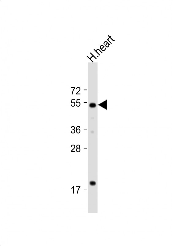 WB - HtrA3 Antibody (N-term) AP1332a