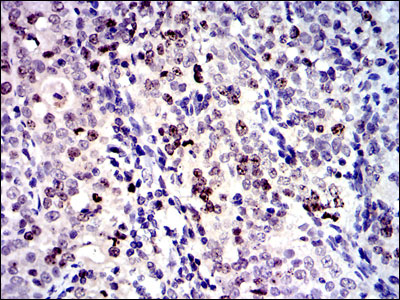 IHC - BIRC5 Antibody AO1653a