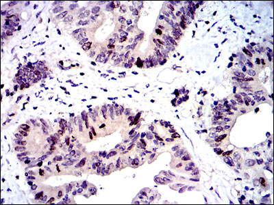 IHC - BIRC5 Antibody AO1653a