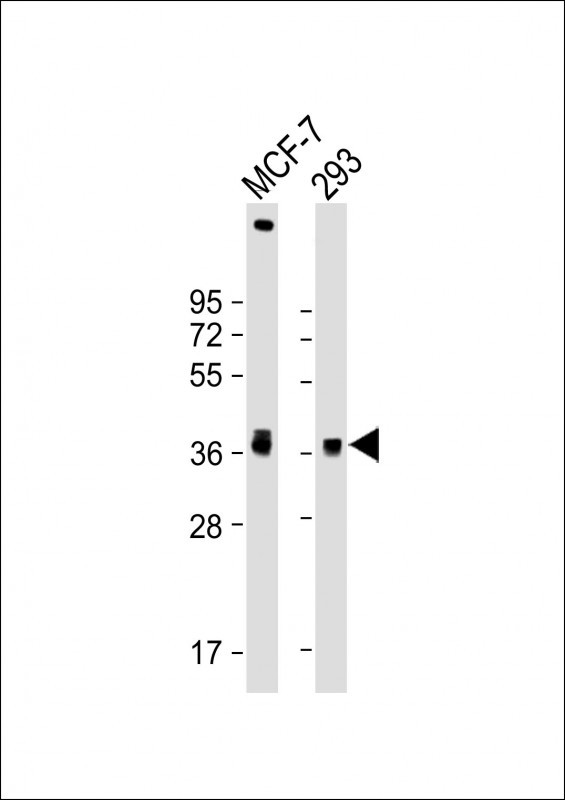 WB - VEGFD Antibody AM1101a