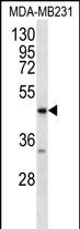 WB - RAGE (AGER) Antibody (C-term) AP2401B