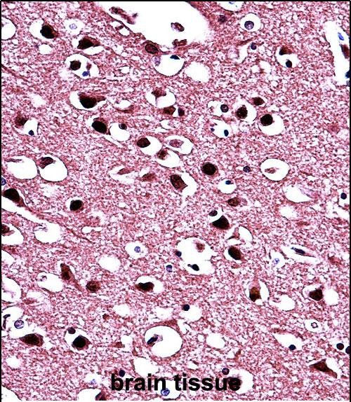 IHC-P - BIN1 Antibody (Center) AP14348c