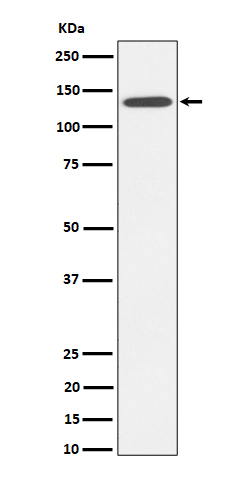  - Anti-R Cadherin Rabbit Monoclonal Antibody ABO16337