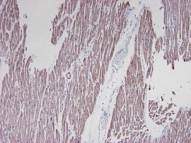 Figure 2. Formalin fixed, paraffin embedded human heart tissue immunostained for actin with MUB0107P (clone HHF35) at a 1:250 dilution.