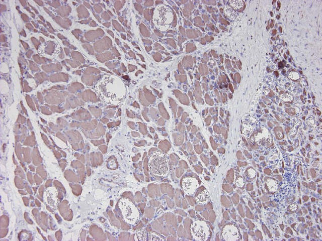 Figure 4. Formalin fixed, paraffin embedded human tongue tissue, immunostained for actin using MUB0107P (clone HHF35) at a 1:250 dilution. Note staining of striated muscle cells and no reactivity on the epithelium and connective tissue.