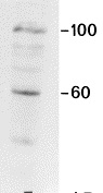 Figure 3. Immunoblotting result of MUB0307P (R2G) on a mitochondrion isolation from swine heart