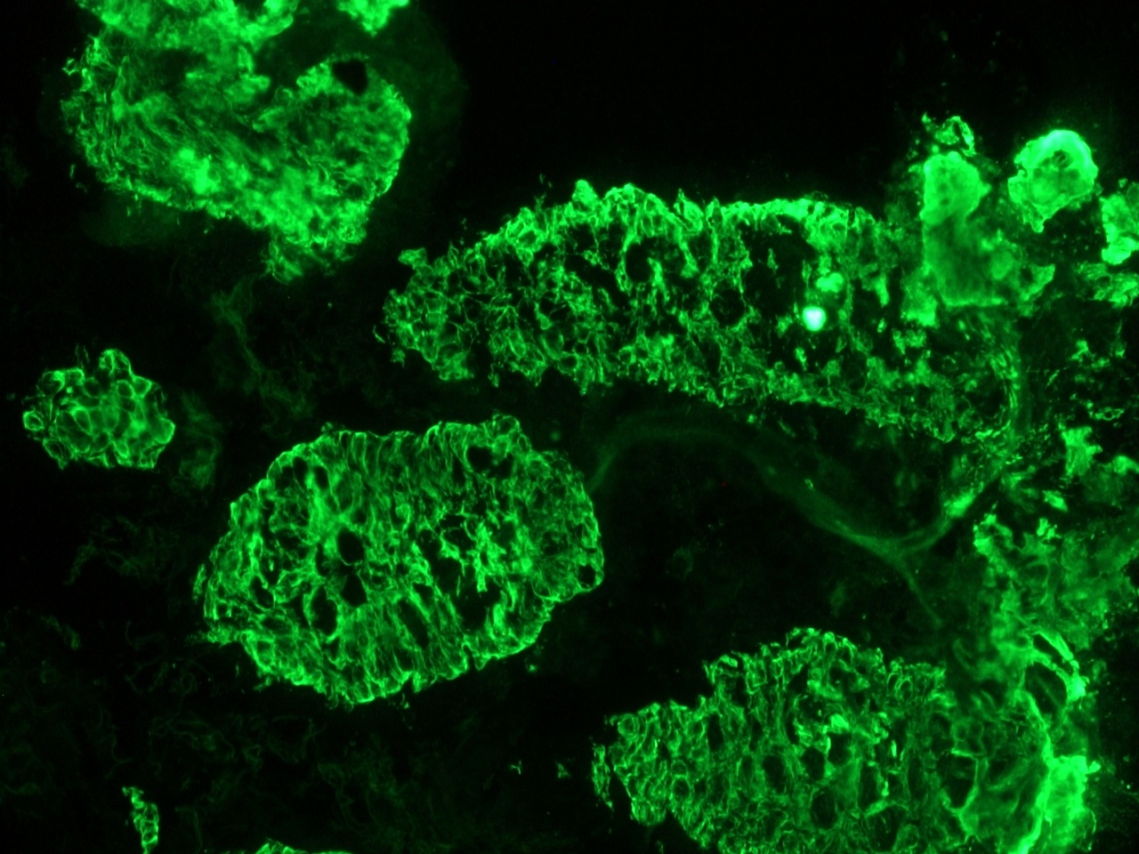 Figure 5 - Immunohistochemistry of MUB0315P (RCK105) on frozen section of human urinary bladder showing positive staining in the epithelial cells and no reactivity in connective tissue. Dilution 1:500