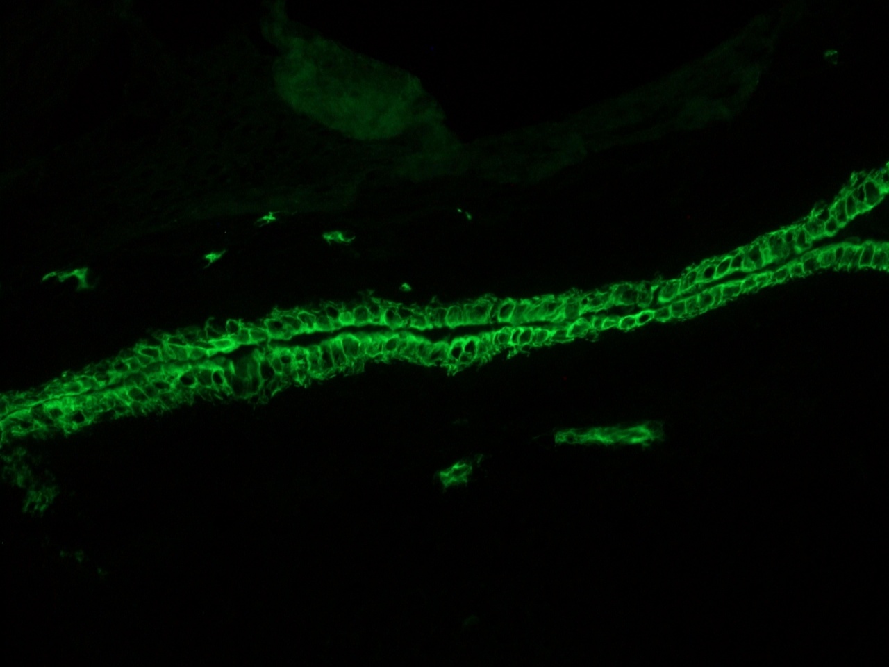 Figure 7 - Immunohistochemistry of MUB0315P (RCK105) on frozen sections of swine liver showing positive staining in the epithelial cells lining the bile ducts and no reactivity in hepatocytes or connective tissue. Dilution 1:500