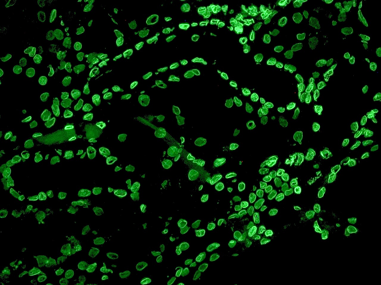 Figure 3. MUB1104P immunohistochemistry on a frozen section of human kidney showing nuclear lamina staining in the ductal epithelium.