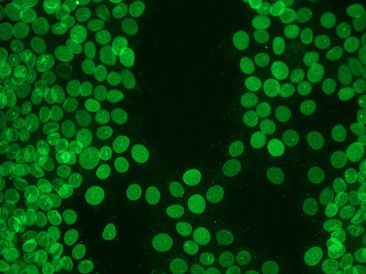 Figure 1. Immunohistochemistry of MCF-7 cell culture showing nuclear lamina staining.