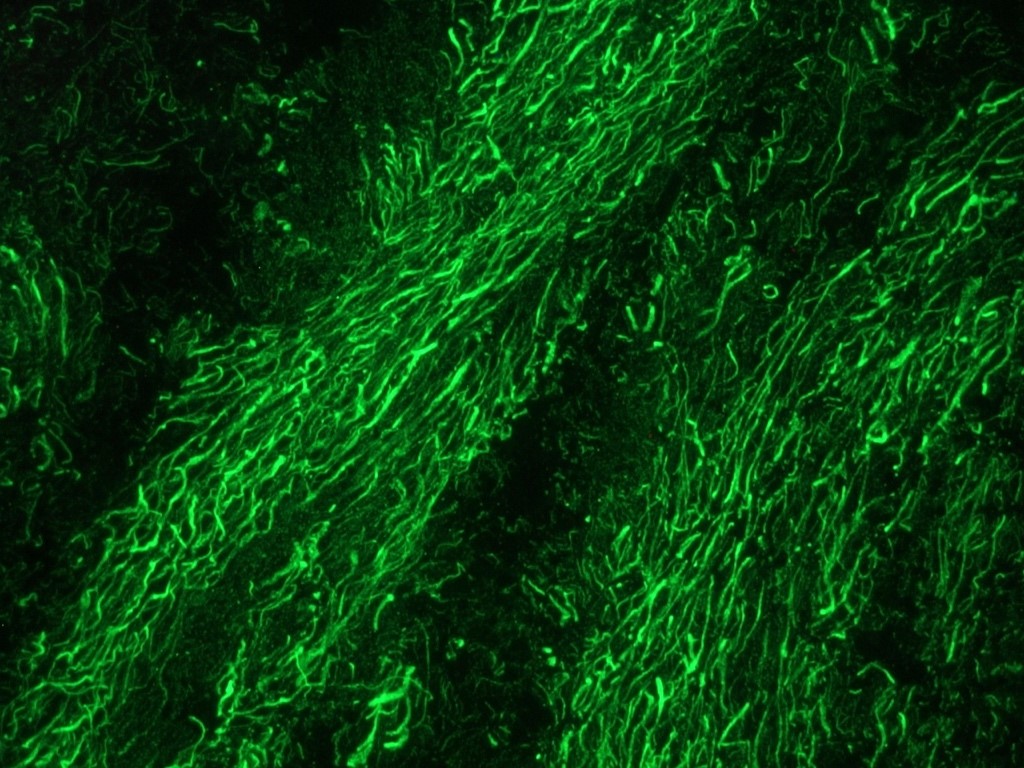 Figure 1. Indirect immunofluorescent detection of the 160 kDa neurofilament protein in rat brain using MUB1304P (RNF403; dilution 1:100).