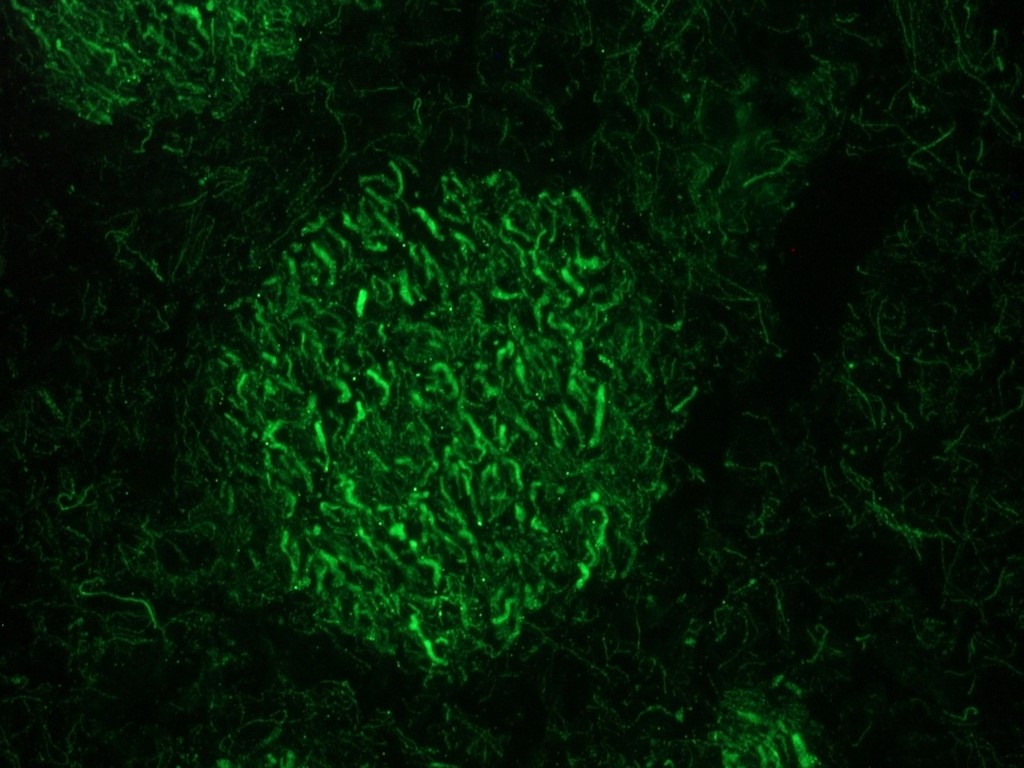 Figure 2. Indirect immunofluorescent detection of the 160 kDa neurofilament protein in rat brain using MUB1304P (RNF403; dilution 1:100).