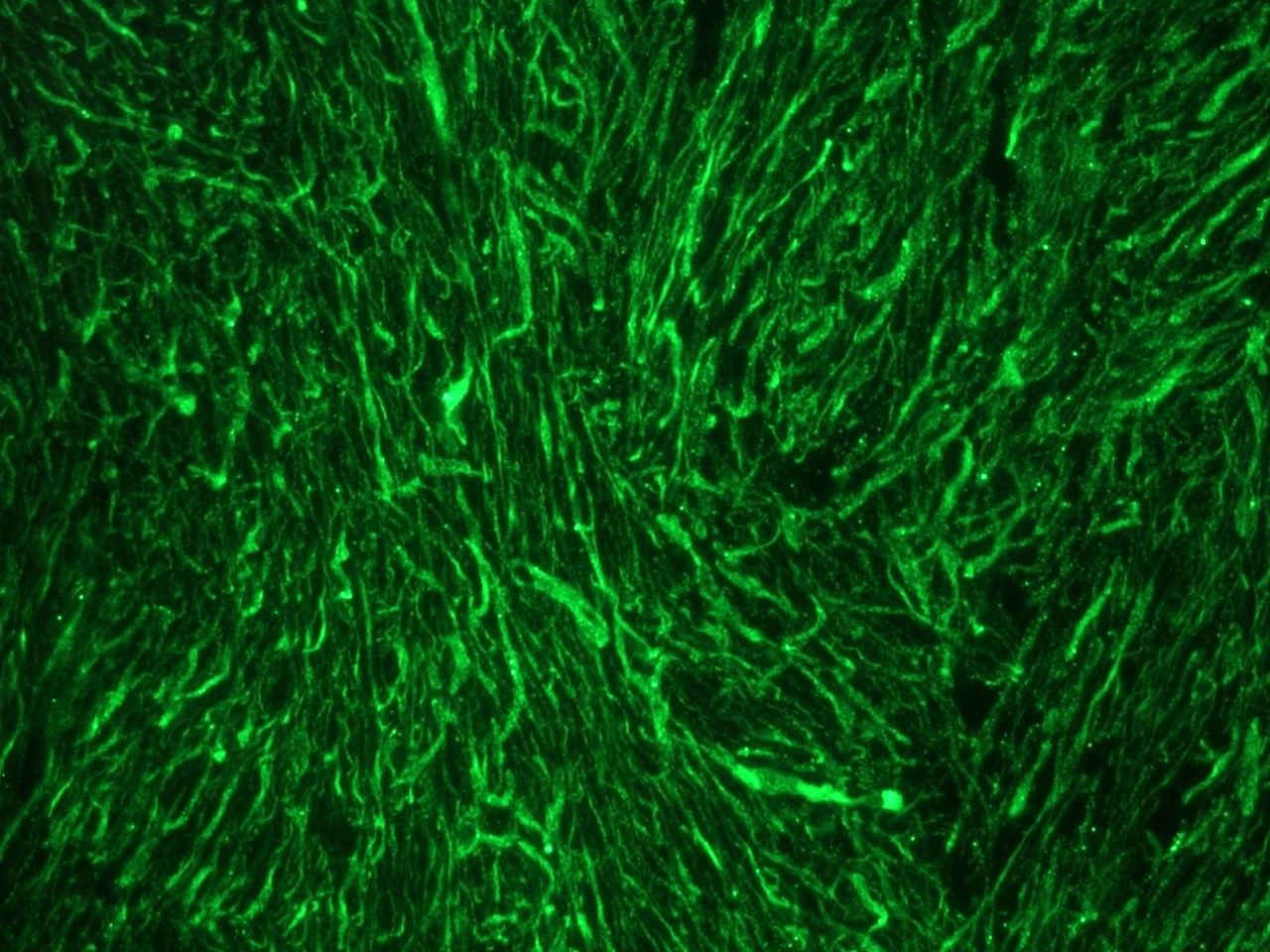 Figure 3. Indirect immunofluorescent detection of the 160 kDa neurofilament protein in rat brain using MUB1304P (RNF403; dilution 1:100).