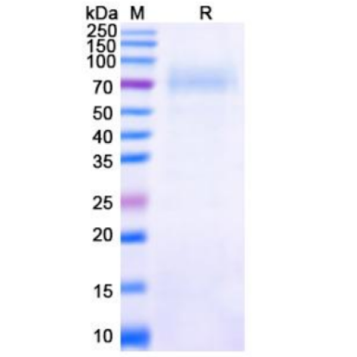 SDS-PAGE analysis of recombinant Nipah Virus glycoprotein G.