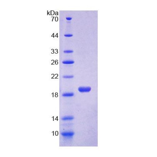 SDS-PAGE analysis of C-C Motif Chemokine Ligand 2 Protein.