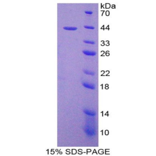 SDS-PAGE analysis of C-C Motif Chemokine Ligand 8 Protein.